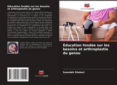 Capa do livro de Éducation fondée sur les besoins et arthroplastie du genou 