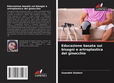 Bookcover of Educazione basata sui bisogni e artroplastica del ginocchio