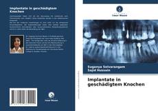 Copertina di Implantate in geschädigtem Knochen