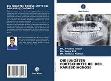 Bookcover of DIE JÜNGSTEN FORTSCHRITTE BEI DER KARIESDIAGNOSE