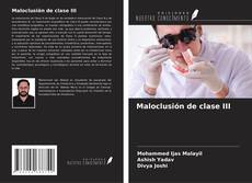 Bookcover of Maloclusión de clase III