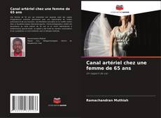 Обложка Canal artériel chez une femme de 65 ans