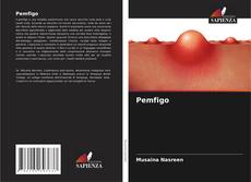 Buchcover von Pemfigo