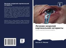 Bookcover of Лечение незрелой кортикальной катаракты