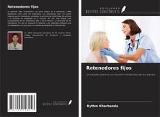 Bookcover of Retenedores fijos