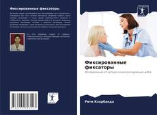 Buchcover von Фиксированные фиксаторы