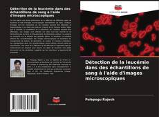 Détection de la leucémie dans des échantillons de sang à l'aide d'images microscopiques kitap kapağı
