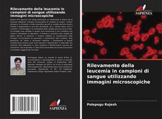 Copertina di Rilevamento della leucemia in campioni di sangue utilizzando immagini microscopiche