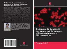 Detecção de Leucemia em amostras de sangue utilizando Imagens Microscópicas kitap kapağı