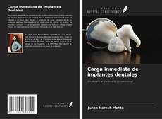 Carga inmediata de implantes dentales kitap kapağı