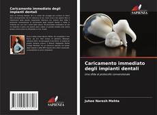 Caricamento immediato degli impianti dentali kitap kapağı