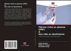 Portada del libro de FIbrine riche en plasma (PRF) & Son rôle en dentisterie