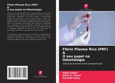 Обложка FIbrin Plasma Rico (PRF) & O seu papel na Odontologia