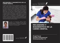 Bookcover of MECANISMO Y DIAGNÓSTICO DE LA CARIES DENTAL
