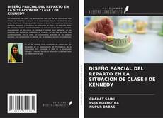 Copertina di DISEÑO PARCIAL DEL REPARTO EN LA SITUACIÓN DE CLASE I DE KENNEDY