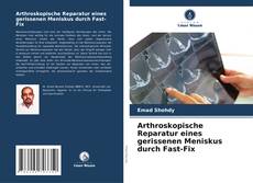 Arthroskopische Reparatur eines gerissenen Meniskus durch Fast-Fix kitap kapağı
