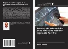 Bookcover of Reparación artroscópica de la rotura de menisco mediante Fast-Fix