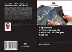 Buchcover von Réparation arthroscopique du ménisque déchiré par Fast-Fix