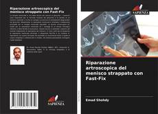 Buchcover von Riparazione artroscopica del menisco strappato con Fast-Fix