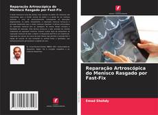 Bookcover of Reparação Artroscópica do Menisco Rasgado por Fast-Fix