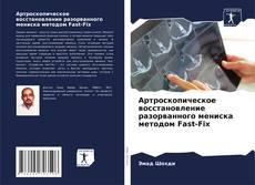 Capa do livro de Артроскопическое восстановление разорванного мениска методом Fast-Fix 