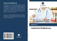 Bookcover of Implantat Bildgebung