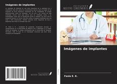 Buchcover von Imágenes de implantes