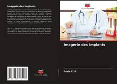 Imagerie des implants kitap kapağı