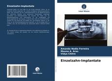 Capa do livro de Einzelzahn-Implantate 