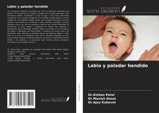 Bookcover of Labio y paladar hendido