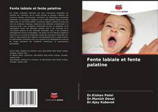 Buchcover von Fente labiale et fente palatine