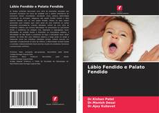 Bookcover of Lábio Fendido e Palato Fendido