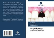Fortschritte im Implantatdesign kitap kapağı