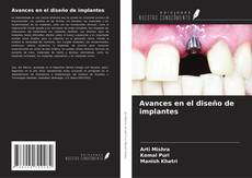 Buchcover von Avances en el diseño de implantes