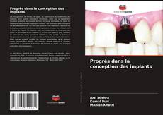 Bookcover of Progrès dans la conception des implants