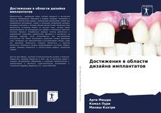 Bookcover of Достижения в области дизайна имплантатов