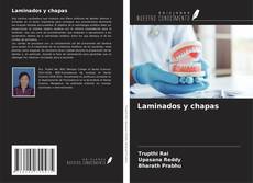Bookcover of Laminados y chapas