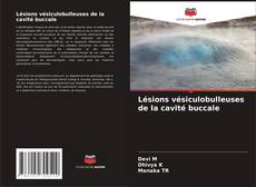 Buchcover von Lésions vésiculobulleuses de la cavité buccale