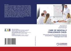 Buchcover von CARE OF MENTALLY CHALLENGED CHILD: