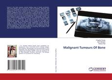 Buchcover von Malignant Tumours Of Bone
