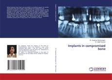 Copertina di Implants in compromised bone
