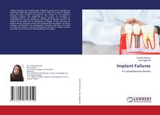 Copertina di Implant Failures