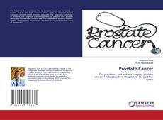 Buchcover von Prostate Cancer