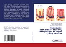Buchcover von Еволюційні особливості розвитку захворювань на карієс зубів у людини