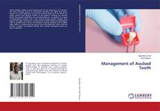 Buchcover von Management of Avulsed Tooth