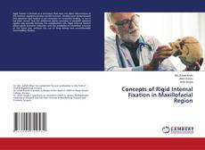 Buchcover von Concepts of Rigid Internal Fixation in Maxillofacial Region