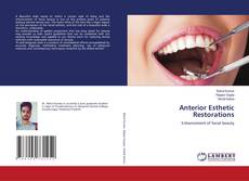 Buchcover von Anterior Esthetic Restorations