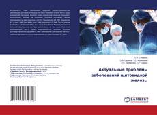Buchcover von Актуальные проблемы заболеваний щитовидной железы