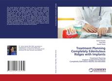 Copertina di Treatment Planning Completely Edentulous Ridges with Implants