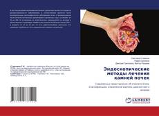 Buchcover von Эндоскопические методы лечения камней почек